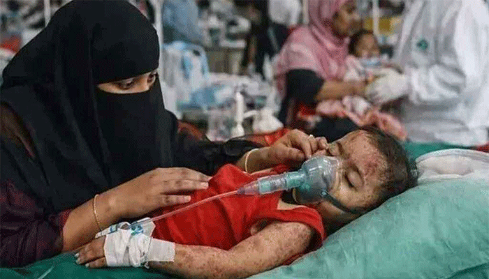 হাম ও উপসর্গ নিয়ে ৮ শিশুর মৃত্যু